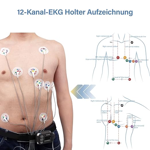 Wellue EKG Gerät 12 Kanal, 24h Holter EKG Monitor mit AI-ECG Analyse, Funktioniert mit PC und Mac, Tragbarer Mobiles 6 8 Kanal 24-Stunden Langzeit EKG Gerät für Zuhause